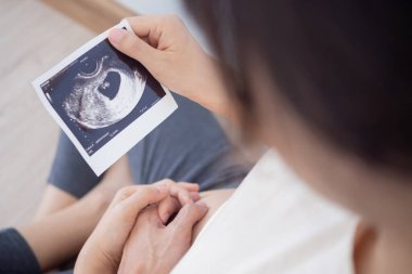 Hamile bir kadın ceninin ultrason fotoğrafına bakıyor. Anne bebeğin karnına hafifçe dokunur. Mutlu, aile, büyüme, gebelik, keyif, yeni doğan, bakım, sağlık, mide.