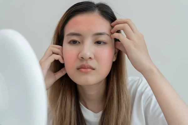 Wanita Muda Asia Khawatir Tentang Wajah Dermatologi Dan Alergi Terhadap — Stok Foto