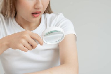 Cilt sorunu ve güzellik. Asyalı kadın deri alerjisi, şok, steroid alerjisi, hassas, kimyasal alerji, kızarıklık, böcek ısırıkları, Seborrheic Dermatitis yüzünden kaşındırıcı cam kullanıyor..