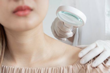 Asyalı bir kızın cilt sorunu ve güzelliği. Cilt bakımı uzmanları cilt alerjisi, steroid alerjisi, hassas cilt, kimyasal alerji, isilik, böcek ısırığı, dermatit....