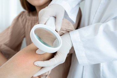 Asyalı bir kızın cilt sorunu ve güzelliği. Cilt bakımı, cilt alerjisi, steroid alerjisi, hassas cilt, kimyasal alerji, isilik, böcek ısırığı, cilt iltihabı....