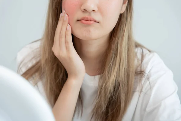Wanita Muda Asia Khawatir Tentang Wajah Dermatologi Dan Alergi Terhadap — Stok Foto