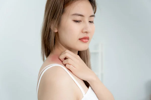 skin problem and beauty. Young woman scratch body has itchy skin from skin allergic, steroid allergy, sensitive skin, red from sunburn, chemical allergy, rash, insect bites, Seborrheic Dermatitis.