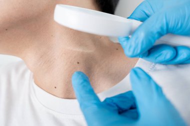 Asyalı bir adamın cilt problemi. Cilt bakımı, cilt alerjisi, steroid alerjisi, hassas cilt, kimyasal alerji, isilik, böcek ısırığı, cilt iltihabı....