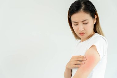Cilt sorunu ve güzellik. Cilt alerjisi, steroid alerjisi, hassas cilt, güneş yanığı, kimyasal alerji, isilik, böcek ısırığı, Seborrheic Dermatitis..