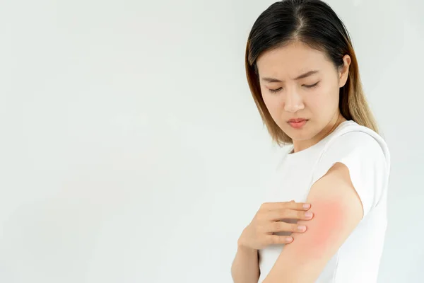 stock image skin problem and beauty. Young woman scratch body has itchy skin from skin allergic, steroid allergy, sensitive skin, red from sunburn, chemical allergy, rash, insect bites, Seborrheic Dermatitis.