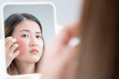 Woman worried about face Dermatology, rosacea dermatitis, allergic steroids, sensitive skin, red face from sunburn, acne, dry skin, large pores ,rash face, dull, freckles, wrinkle, skin problem, beauty