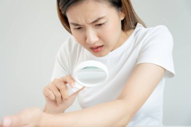 Cilt sorunu ve güzellik. Asyalı kadın deri alerjisi, şok, steroid alerjisi, hassas, kimyasal alerji, kızarıklık, böcek ısırıkları, Seborrheic Dermatitis yüzünden kaşındırıcı cam kullanıyor..