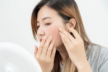 Young woman are worried about faces Dermatology and allergic to steroids in cosmetics. sensitive skin, red face from sunburn, acne, allergic to chemicals, rash on face. skin problems and beauty