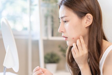 Genç Asyalı kadın, yüz dermatolojisi ve kozmetik ürünlerinde steroidlere alerjisi olduğu için endişeli. Hassas cilt, güneş yanığı, sivilce, kimyasallara alerjisi, yüzünde kızarıklık. cilt sorunları ve güzellik