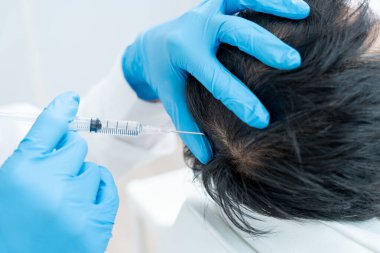 Asyalı erkek için saç enjeksiyonu, saç dökülmesi, saç dökülmesi, seyreltme, vitamin eksikliği, kellik, doğum sonrası, biyotin, çinko, endokrin bozuklukları, hormonal dengesizlik uzmanı.