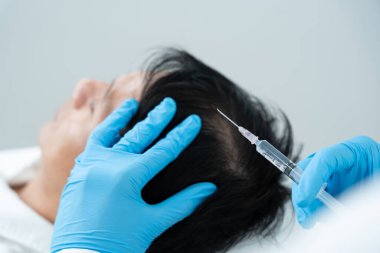 Asyalı erkek için saç enjeksiyonu, saç dökülmesi, saç dökülmesi, seyreltme, vitamin eksikliği, kellik, doğum sonrası, biyotin, çinko, endokrin bozuklukları, hormonal dengesizlik uzmanı.