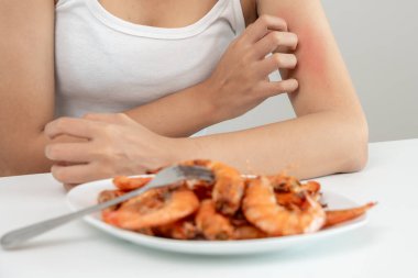 Gıda alerjisi, kadınlar karides yedikten sonra kaşıntı ve kızarıklık, deniz ürünlerine alerji, kaşıntı, kızarıklık, karın ağrısı, ishal, göğüs sıkışması, baygınlık, ölüm, şiddetli alerjiden kaçınma.