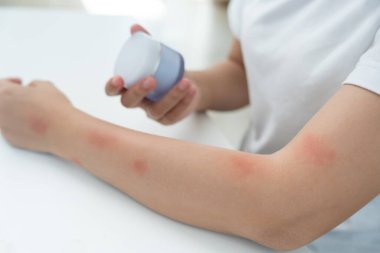 Cilt ve güzellik problemleri: Kadınların cilt kaşıntısı ve kozmetik alerjileri, steroid alerjileri, hassas cilt alerjileri, güneş ışığı kızarıklığı, kimyasal alerjiler, isilikler, böcek ısırıkları,.