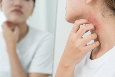 Cilt sorunu ve güzellik. Cilt alerjisi, steroid alerjisi, hassas cilt, güneş yanığı, kimyasal alerji, kızarıklık, böcek ısırıkları, Seborrheic Dermatitis..