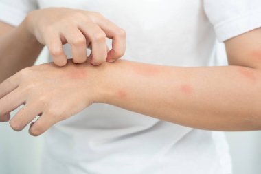 Cilt ve güzellik problemleri: Kadınların cilt kaşıntısı ve kozmetik alerjileri, steroid alerjileri, hassas cilt alerjileri, güneş ışığı kızarıklığı, kimyasal alerjiler, isilikler, böcek ısırıkları,.