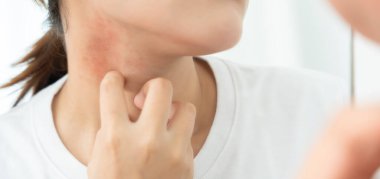 Cilt ve güzellik problemleri: Kadınların cilt kaşıntısı ve kozmetik alerjileri, steroid alerjileri, hassas cilt alerjileri, güneş ışığı kızarıklığı, kimyasal alerjiler, isilikler, böcek ısırıkları,.