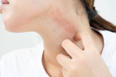 Cilt ve güzellik problemleri: Kadınların cilt kaşıntısı ve kozmetik alerjileri, steroid alerjileri, hassas cilt alerjileri, güneş ışığı kızarıklığı, kimyasal alerjiler, isilikler, böcek ısırıkları,.