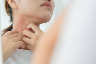 Cilt ve güzellik sorunları Kadınların kaşındıran derileri ve kozmetik alerjileri, steroid alerjileri, hassas ciltleri, güneş ışığı kızarıklıkları, kimyasal alerjileri, isilikleri, böcek ısırıkları yüzünden kızarıklıkları var..