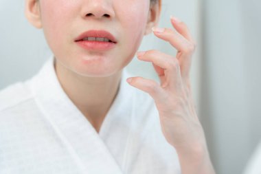 Young woman are worried about faces Dermatology and allergic to steroids in cosmetics. sensitive skin, red face from sunburn, acne, allergic to chemicals, rash on face. skin problems and beauty