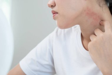 Cilt ve güzellik sorunları Kadınların kaşındıran derileri ve kozmetik alerjileri, steroid alerjileri, hassas ciltleri, güneş ışığı kızarıklıkları, kimyasal alerjileri, isilikleri, böcek ısırıkları yüzünden kızarıklıkları var..