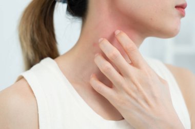 Cilt sorunu ve güzellik. Cilt alerjisi, steroid alerjisi, hassas cilt, güneş yanığı, kimyasal alerji, isilik, böcek ısırığı, Seborrheic Dermatitis..