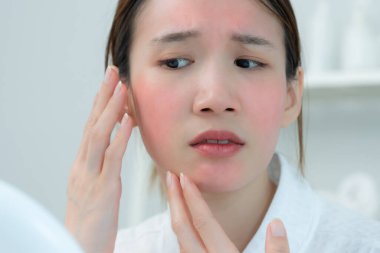 Young woman are worried about faces Dermatology and allergic to steroids in cosmetics. sensitive skin, red face from sunburn, acne, allergic to chemicals, rash on face. skin problems and beauty
