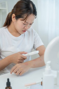 Cilt sorunu ve güzellik. Asyalı kadın deri alerjisi, şok, steroid alerjisi, hassas, kimyasal alerji, kızarıklık, böcek ısırıkları, Seborrheic Dermatitis yüzünden kaşındırıcı cam kullanıyor..