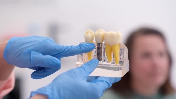 インプラントで歯科モデルのクローズアップ 背景のぼやけた歯科医院の患者 歯科の概念は — ストック動画