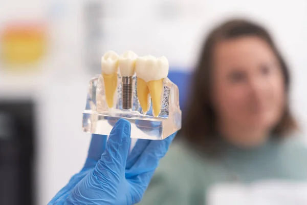 Diş implantı tedavisini açıklayan bir dişçiyi dinleyen yakın plan bir hasta. Dişçilerin eline diş implantı takılıyor.