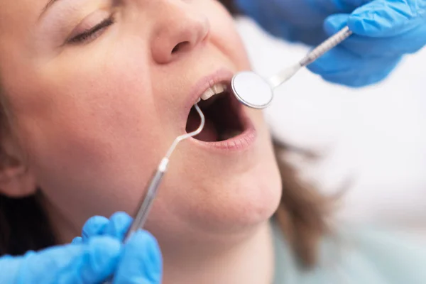 stock image A close-up of a female teeth during a dental check-up. tooth whitening, treatment, and veneers services in our state-of-the-art professional clinic. copy space 