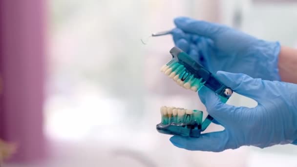 Стоматолог Объясняет План Лечения Женщине Держащей Челюсть Стоматологической Модели Показывающей — стоковое видео
