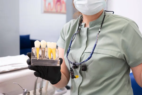 Diş hekimi, diş implantı tacını tanımlayan ve diş implantı bakımı ve ağız hijyeni hakkında talimatlar veren bir insan diş modelini gösteriyor.