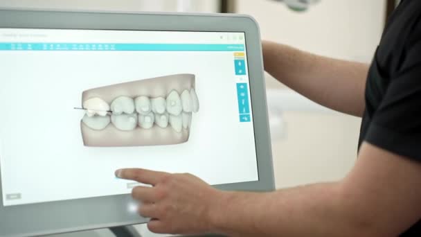 歯科産業開発会議で歯の治療プログラムを提示モニター上の低と上の人間の顎モデルを示す熟練した歯科医 — ストック動画