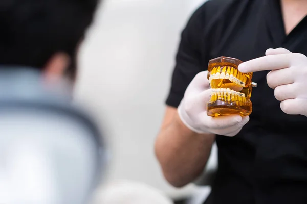 Стоматолог Захисними Рукавичками Вказують Металеві Зубні Дужки Встановлені Моделі Людських — стокове фото