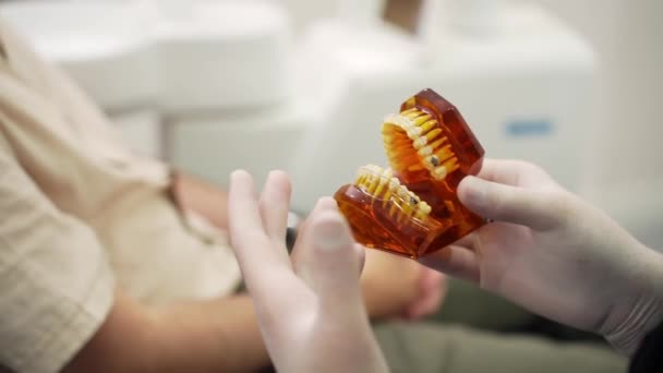 Tandarts Met Latex Handschoenen Houden Menselijke Kaken Model Met Geïnstalleerde — Stockvideo