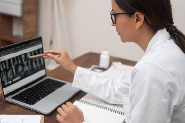 Gözlüklü genç doktor, dizüstü bilgisayara kalemle işaret eden röntgen görüntülerine bakıyor. Travma uzmanı, muayene sonuçlarıyla çalışan hastaya yan görüş tanısı koyuyor.