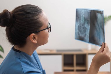 Genç doktor hastanın röntgen görüntülerini inceliyor. Yan görüş kadın sıhhiye modern klinikteki bulanık arka plan çalışmaları üzerine ofisinde oturan muayene verileriyle çalışıyor.