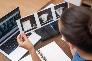 Teşhis Ultrasonu: Doktor mavi önlüğüyle ultrason görüntülerini gözden geçirir ve kapsamlı hasta kayıtları için laptopunda titiz notlar tutar..