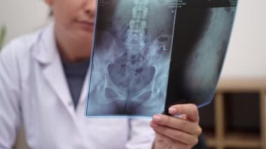 Radyografik yakın çekim: Doktor radyoloji uzmanı röntgen filmi tutuyor, sonuçları değerlendiriyor.. 