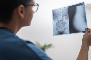 Doktorun mavi önlük giyip, radyolojinin röntgen filmini incelemeye odaklandığı yakın plan fotoğrafı.