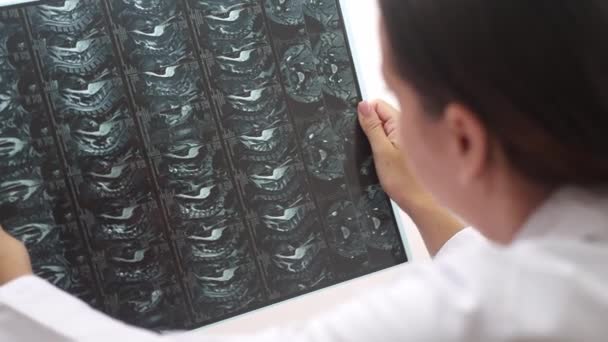 Nahaufnahme Arzt Führt Eine Online Konsultation Durch Untersucht Patienten Röntgenfilme — Stockvideo
