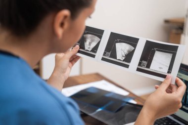 Tüp bebek ultrason muayenesi: Doktor ultrason sonuçlarını inceliyor, bilgisayarına detaylı notlar kaydediyor. 