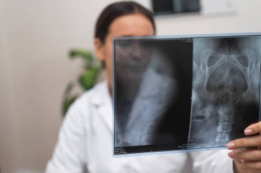 Tanı Radyografisi: Hastanede bir doktor, tıbbi sağlık hizmetlerinin bir parçası olarak radyolojik bir röntgen filmi kullanarak hastaların hastalıkları hakkında bir teşhis değerlendirmesi yapıyor.