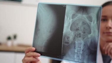 Radyoloji doktorunun hastalarını tuttuğu röntgen filmi sonuçları yorumluyor..