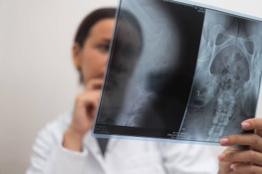 Radyolojik röntgen filmi kullanarak hastaların durumuna bakıyorum.