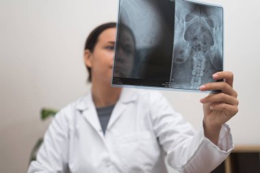 Teşhis Muayenesi: Hastanede, doktor hastaların röntgen filmlerini dikkatlice değerlendirir, radyoloji uzmanı röntgen sonuçlarının detaylı bir incelemesini yapar. 