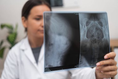 Tıbbi Teşhis: Bir doktor, hastanedeki sağlık hizmetlerinin bir parçası olarak bir hastanın hastalığını teşhis etmek için radyolojik göğüs röntgeni çeker. 