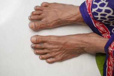 Üst kattaki yaşlı kadınların ayaklarının manzarası