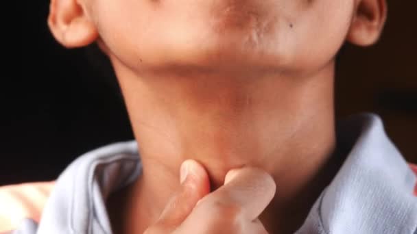 Junge Leidet Unter Halsschmerzen Aus Nächster Nähe — Stockvideo